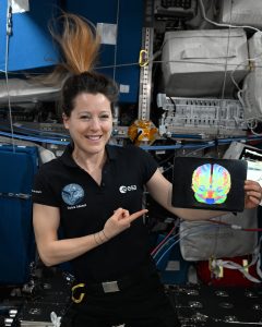La astronauta Sophie Adenot sostiene una imagen de resonancia cerebral en la Estación Espacial Internacional.