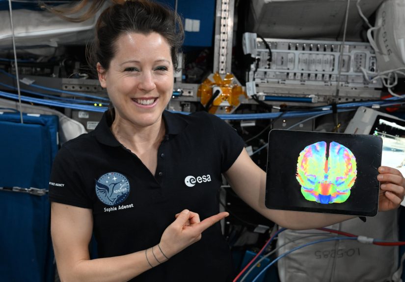 La astronauta Sophie Adenot sostiene una imagen de resonancia cerebral en la Estación Espacial Internacional.